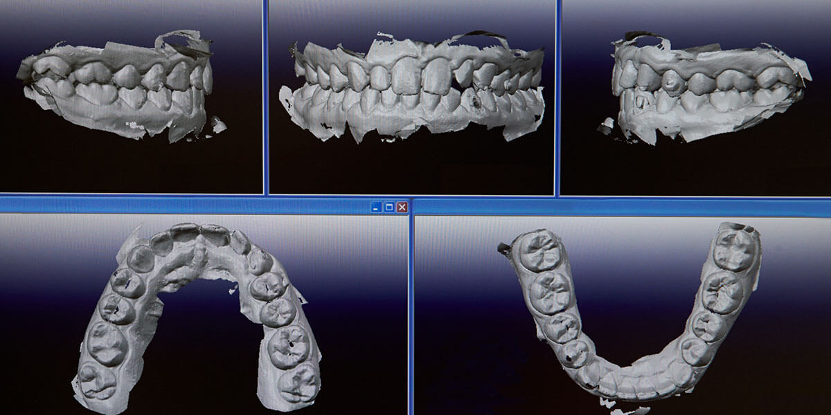 Examples of Digital Impressions