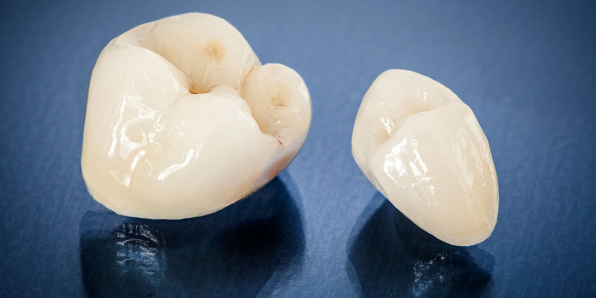 Dental Crowns