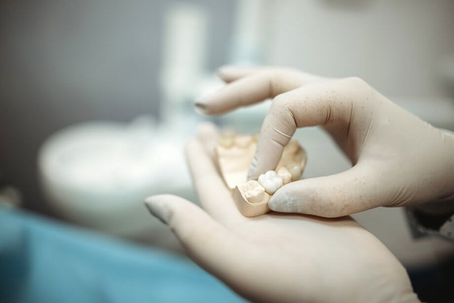 The Pros and Cons of Dental Crowns